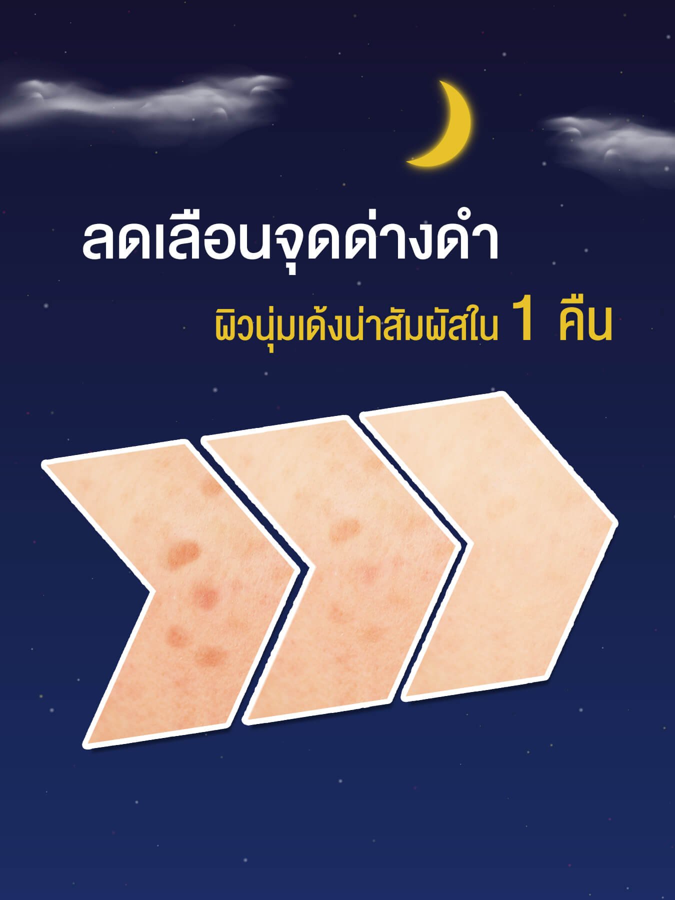 ลดเลือนจุดด่างดำครีมกลางคืน